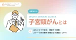 子宮頚がんの主なリスクや症状、検査から診断、ステージ別分類や治療方法の選択について
