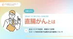 直腸がんの主なリスクや症状、検査から診断、ステージ別生存率や治療方法の選択について